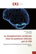 La toxoplasmose cérébrale chez les patients infectés par le VIH