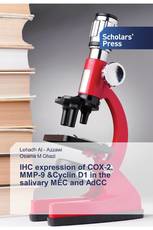 IHC expression of COX-2, MMP-9 &Cyclin D1 in the salivary MEC and AdCC