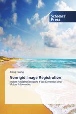 Nonrigid Image Registration