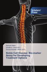 Sickle Cell Disease: Bio-marker Assay for Developing Treatment Options