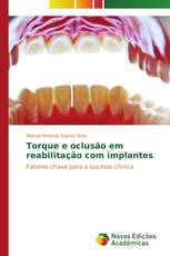 Torque e oclusão em reabilitação com implantes