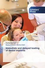 Immediate and delayed loading of dental implants