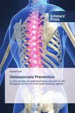 Osteoporosis Prevention