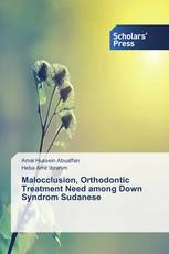 Malocclusion, Orthodontic Treatment Need among Down Syndrom Sudanese
