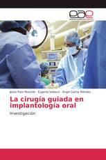 La cirugía guiada en implantología oral