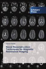 Novel Reconstruction Techniques for Magnetic Resonance Imaging