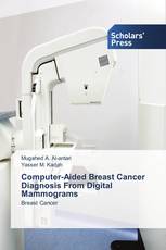 Computer-Aided Breast Cancer Diagnosis From Digital Mammograms