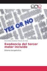 Exodoncia del tercer molar incluido