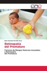 Retinopatía del Prematuro