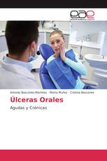 Úlceras Orales