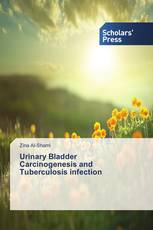 Urinary Bladder Carcinogenesis and Tuberculosis infection