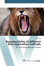 Reproducibility of different bite registration methods