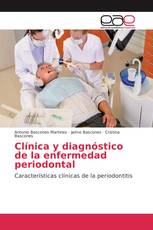 Clínica y diagnóstico de la enfermedad periodontal