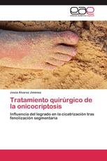Tratamiento quirúrgico de la onicocriptosis