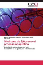 Síndrome de Sjögren y el proceso apoptótico