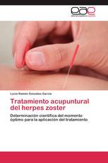 Tratamiento acupuntural del herpes zoster