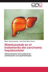 Nimotuzumab en el tratamiento del carcinoma hepatocelular