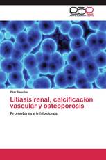 Litiasis renal, calcificación vascular y osteoporosis