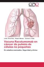 Vacuna Racotumomab en cáncer de pulmón de células no pequeñas