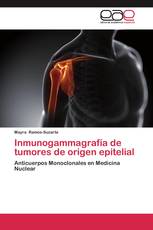 Inmunogammagrafía de tumores de origen epitelial