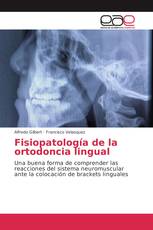 Fisiopatología de la ortodoncia lingual