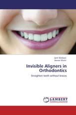 Invisible Aligners in Orthodontics