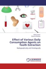 Effect of Various Daily Consumption Agents on Tooth Extraction