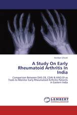 A Study On Early Rheumatoid Arthritis In India