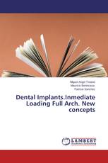 Dental Implants.Inmediate Loading Full Arch. New concepts