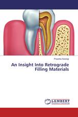 An Insight Into Retrograde Filling Materials