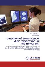 Detection of Breast Cancer Microcalcifications in Mammograms