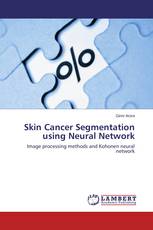 Skin Cancer Segmentation using Neural Network