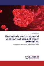 Thrombosis and anatomical variations of veins of lower extremities