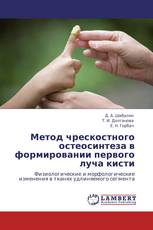 Метод чрескостного остеосинтеза в формировании первого луча кисти