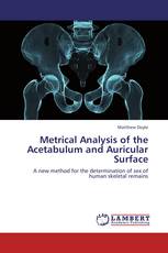 Metrical Analysis of the Acetabulum and Auricular Surface