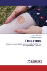 Гонартроз