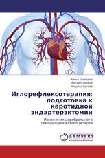 Иглорефлексотерапия: подготовка к каротидной эндартерэктомии