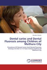 Dental caries and Dental Fluorosis among Children of Mathura City