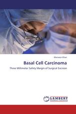 Basal Cell Carcinoma