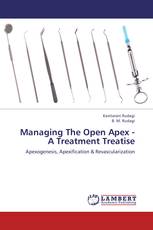 Managing The Open Apex - A Treatment Treatise