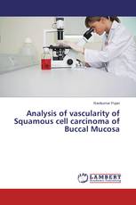 Analysis of vascularity of Squamous cell carcinoma of Buccal Mucosa