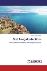 Oral Fungal Infections