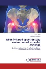 Near infrared spectroscopy evaluation of articular cartilage