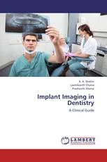 Implant Imaging in Dentistry