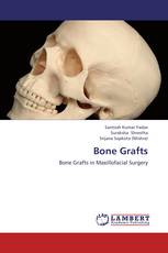 Bone Grafts