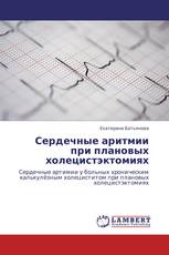 Сердечные аритмии при плановых холецистэктомиях