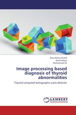 Image processing based diagnosis of thyroid abnormalities
