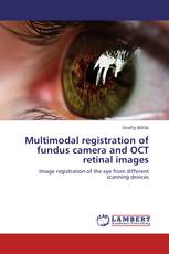 Multimodal registration of fundus camera and OCT retinal images