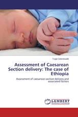 Assessment of Caesarean Section delivery: The case of Ethiopia