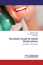 Porcelain fused to metal Restorations